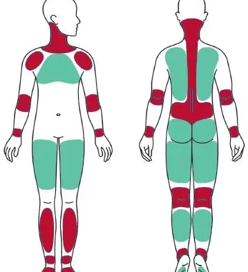 绳艺教程-11.事后护理和现场后处理